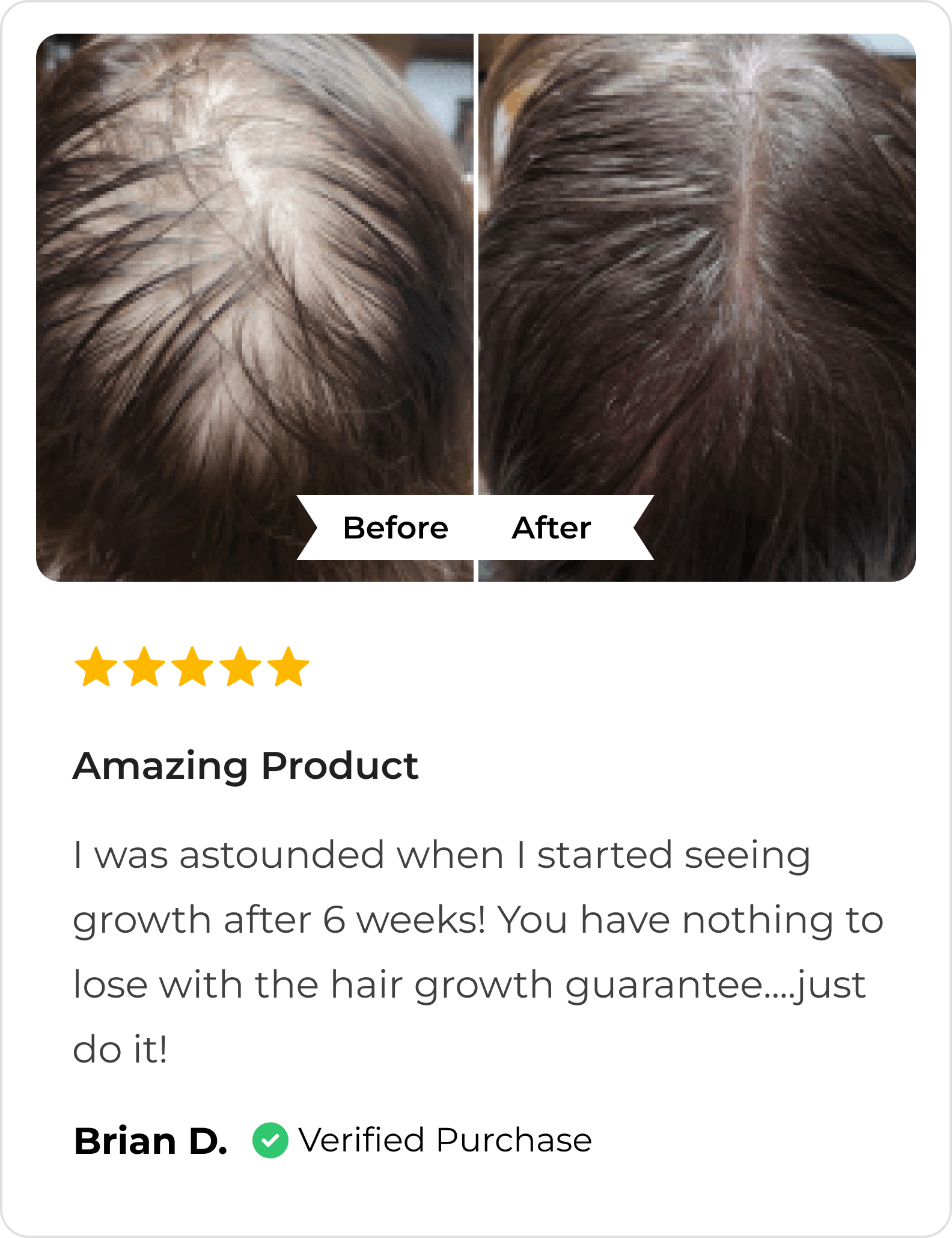 before-after