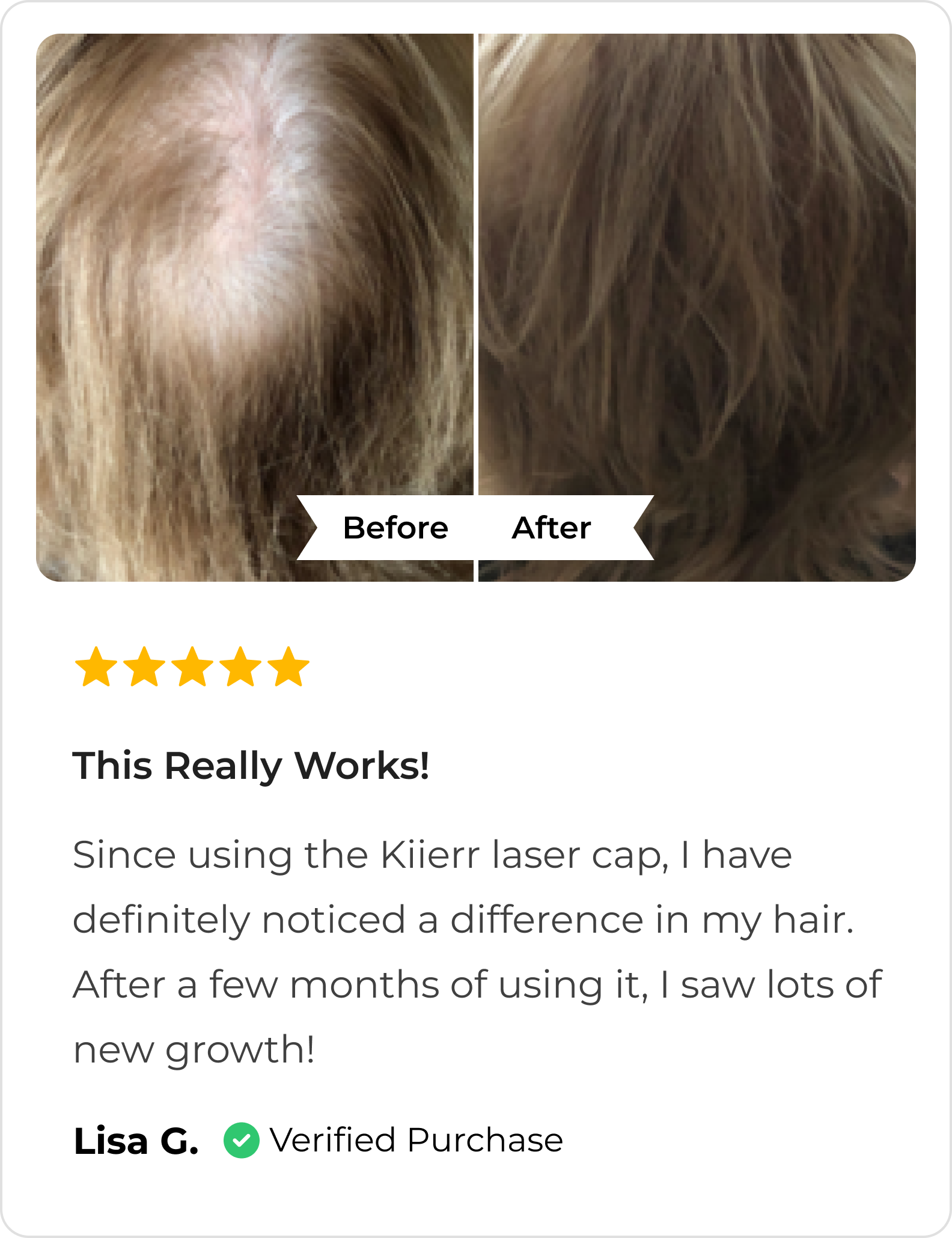 before-after